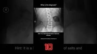 Abdominal X-ray Question 12
