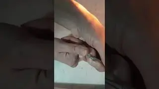 Семянотерапия 🍀при головной боли. 