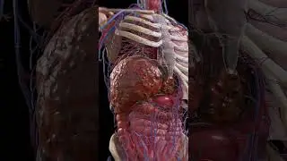 Cirrhosis: Liver Under Siege  