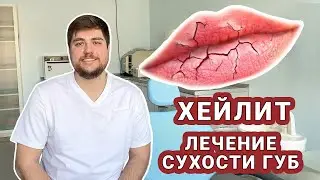 Cheilite. Causes and treatment of dry lips.