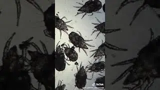 Honey Under Microscope