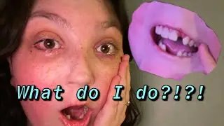 My Teeth Are Falling Out Of My Head!!! | Lydia Black