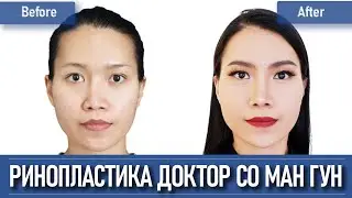 Rhinoplasty in Korea interview with one of the best surgeon in Korea  [English Sub]