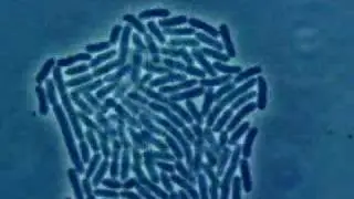 Bacteria Growth