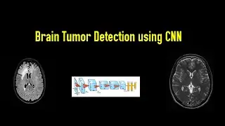 Brain Tumor Detection using CNN | Deep Learning Tutorial | CNN Implementation
