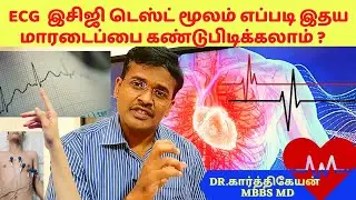 How ECG machine🧳 diagnoses heart❤️💛💕 problems?-dr karthikeyan tamil