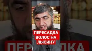 ПЕРЕСАДКА ВОЛОС