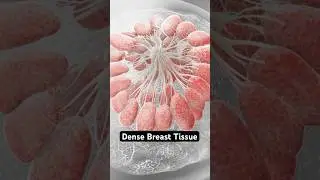 Dense Breast Tissue (3D Animation)