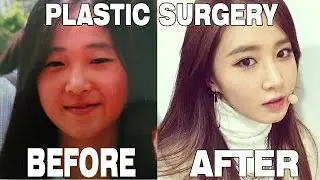 KPOP STARS BEFORE AND AFTER PLASTIC SURGERY