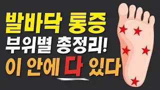 발바닥 통증 부위별로 정확히 알려드립니다. (무지외반증,통풍,지간신경종,중족골통증,족저근막염,아킬레스건염 등)