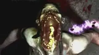 Spitter spits on you - "Live 4 Ever"