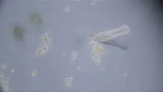 Chaetonotus