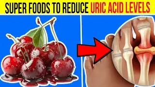 Top 10 Super Foods Lowering Uric Acid