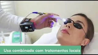 ILIB Plus - Aparelho de Terapia ILIB