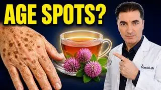 AGE SPOTS DISAPPEAR FOREVER! Take this natural MEDICINE...