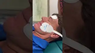 Instant facelift with no needles? EMFace is here to help! #facialcontouring #snatchedjaw