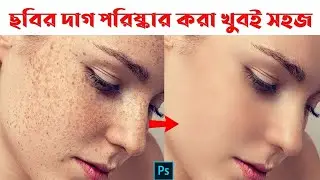 How to Remove Dark Spots  and  Quickly Smooth Skin Photoshop Bangla tutorial
