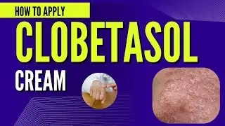 Clobetasol propionate Cream for Skin Inflammation : How to Apply?