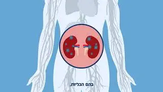 ספסיס - גורם המוות שאפשר לנצח