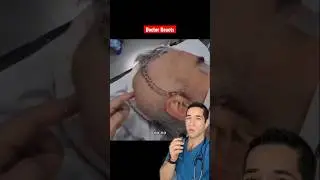 Why does everyone want to poke the brain like that?!