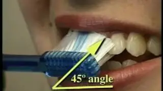 How to Brush your Teeth