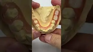 For posteriors!