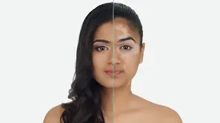 Vitiligo / White Patches Makeup Theory  How to Cover Vitiligo waterproof with Kryolan @radiantglow138
