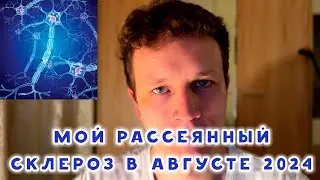 КАК Я ЖИВУ С РАССЕЯННЫМ СКЛЕРОЗОМ. МОЯ ДИНАМИКА
