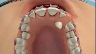 Неровные зубы - это не катострофа