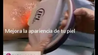 Depilacion