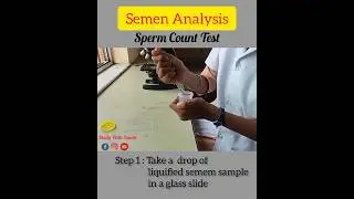 “Semen Analysis: What's Your Sperm Count?” Understanding Semen Analysis: Sperm Count, Motility