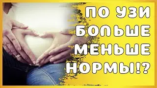 По УЗИ вес или рост плода выше или ниже нормы - это как?!