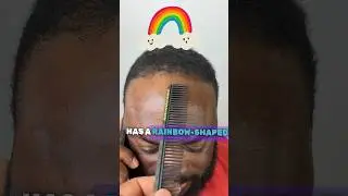 Rainbow Shaped Hairline fix 🌈💈 
