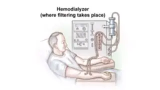 Dialysis Access and Fistula Procedure