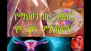 Ethiopia|  የማህፀን በር ጫፍ ካንሰር ምልክቶች እና ምርመራ