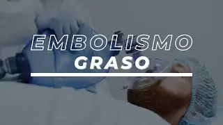 Embolismo graso - Prevención, diagnóstico y manejo