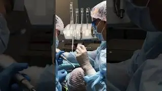 Имплантация