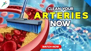Try this  drink to avoid Heart Attacks  | Drinks To Detox Arteries  | Fitistan – Ek Fit Bharat
