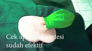 PROSEDUR SIRKUMSISI