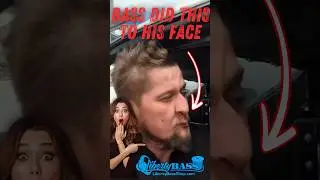 THE BASS DID THIS TO HIS FACE 😳👀
