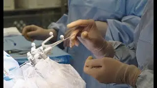 Robotyczne usuwanie guzów mózgu i lekoopornej padaczki u dzieci