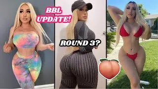 BBL UPDATE! Round 3? Complications years later?