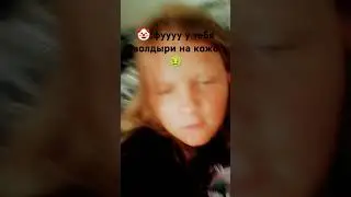 а вот про солнечный ожог было лишнее! 😖