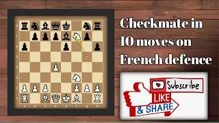 Checkmate in 10moves on French defence | Chess Trap | IG Chess