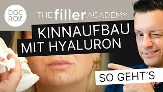 KINNAUFBAU mit HYALURON erklärt! TFA by doc.rolf