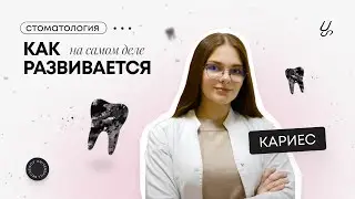 How does tooth decay actually develop?