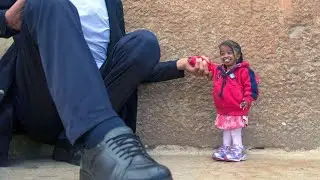 10 World’s Smallest People You Won’t Believe Exist