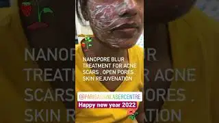 Happy new year 2022 #recap2021 #drashimagoel #shorts #dermatologistinchandigarh #parisaskinclinic