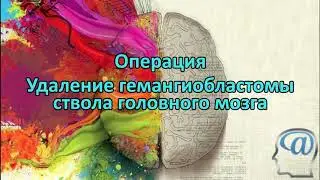 Операция. Удаление гемангиобластомы ствола головного мозга. Нейрохирургия