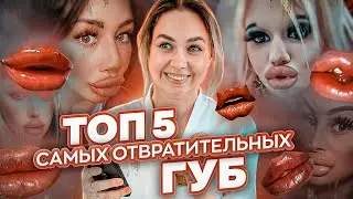 Топ 5 самых отвратительных губ